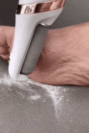 Electric Foot Callus Remover | مزيل كالو القدم الكهربائي