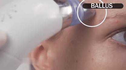 Deep Pore Cleaning Device | جهاز التنظيف العميق للمسام
